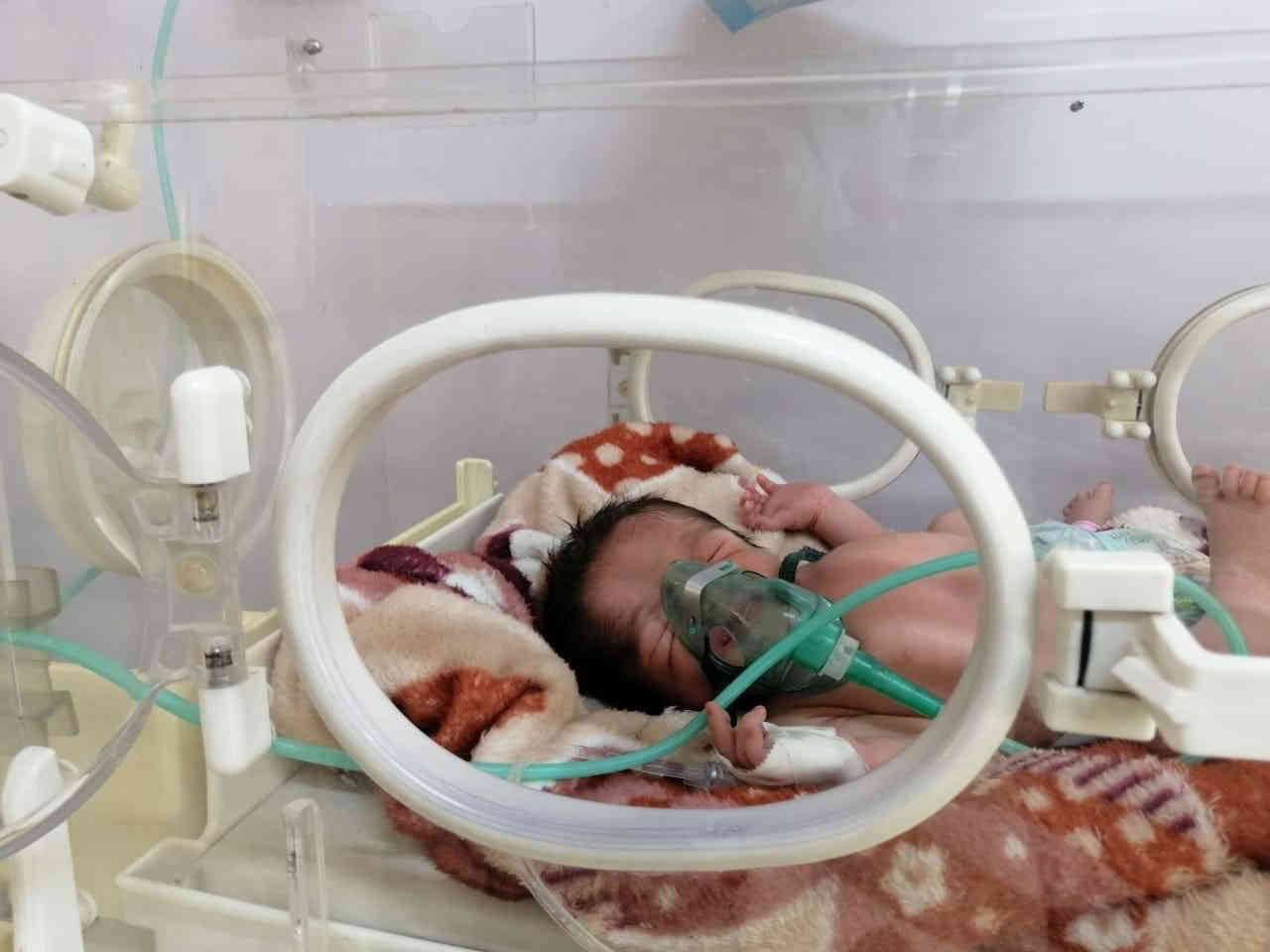 أجرت #الدكتورة_حنان_نجم_الدين_ابراهيم 👩🏻‍⚕️
#أخصائية_جراحة_النسائية_والتوليد 🤰🏼
إجراء عدة #عمليات #جراحية #نسائية #مختلفة ساهمت في الحفاظ على حياة المرضى 🤰🏼🫄🏻🫃🏼👩🏻‍🍼🤱🏽

1️⃣عملية جراحية #استئصال_الرحم من العنق مع المبايض
كانت تعاني من عقدة ليفية كبيرة فوق الرحم وتضخم بالرحم ،بالإضافة انها تعاني من ارتفاع ضغط الدم🩸
🧕🏼 المريضة ((عمرها 57 سنة)) 📆
تم اجراء العملية بنجاح وأرسل ((الرحم مع ملحقاته)) الى الفحص النسيجي 🔬

2️⃣#عملية_استئصال_كيس_دموي على المبيض الأيمن رفع الكيس بدون ازالة المبيض
‏‎#لمريضة عمرها ((32 سنة)) كانت تعاني من خربطة هرمونات الغدة وآلام حادة بالبطن مما أدى إلى إصابتها بخمول وتعب نتيجة فقر الدم الشديد وبعد إجراء الفحوصات المختبرية والسونار تبين أن 
كيس على المبيض الأيمن…

3️⃣ #عملية_رفع_حمل_خارج_الرحم 
لمريضة تبلغ من العمر ((28 سنة))
وكانت تعاني من الآلم شديدة في اسفل البطن بعد الفحص السريري وارسالها الفحوصات اللازمة تم تشخيص وجود حمل خارج الرحم #تم اجراء العملية بنجاح🤰🏼

5️⃣4️⃣6️⃣✨أيضآ #عمليات_جراحية_قيصرية_ولادة #متعددة🤰🏻👼🏻🤱🏻
بإشراف طبيبة الأطفال #الدكتورة_ابتهال_اكرم_مبارك 👩🏻‍⚕️

📝 جميع العمليات تكللت بالنجاح و المريضات حالياً بصحة جيدة وحالتهن مستقرة وهن في طور التماثل الكلي للشفاء بشكل تدريجي…
💐🌹🌷والشكر الموصول الى كل طاقم العمليات👨🏻‍⚕️🧑🏻‍⚕️👩🏼‍⚕️👨🏼‍⚕️

🚹أمنياتنا لكم بدوام الصحة والعافية🌐
----------------------------------
🎙الحجز والمعلومات📱
📲 ***********
📲 ***********
🌍العنوان #طوزخوماتو🇮🇶مقابل جامع الوهاب🕌عيادة الحافظ الجراحية الأهلية 🏨
