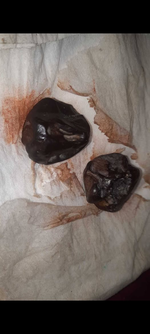 الي يدور على حجر الهبهاب الطبيعي
هذه حجر الهبهاب الطبيعي الخام وخواصه معروفه 
محبه شديده 
جلب محبة الناس لحامله 
تحسين العلاقات عامة وخاصة 
تفاصيل على الخاص


**إذا كنت صاحب هذا الإعلان وتريد حذفه لأي سبب، رجاءا أرسل رسالة إلى الدعم الفني**