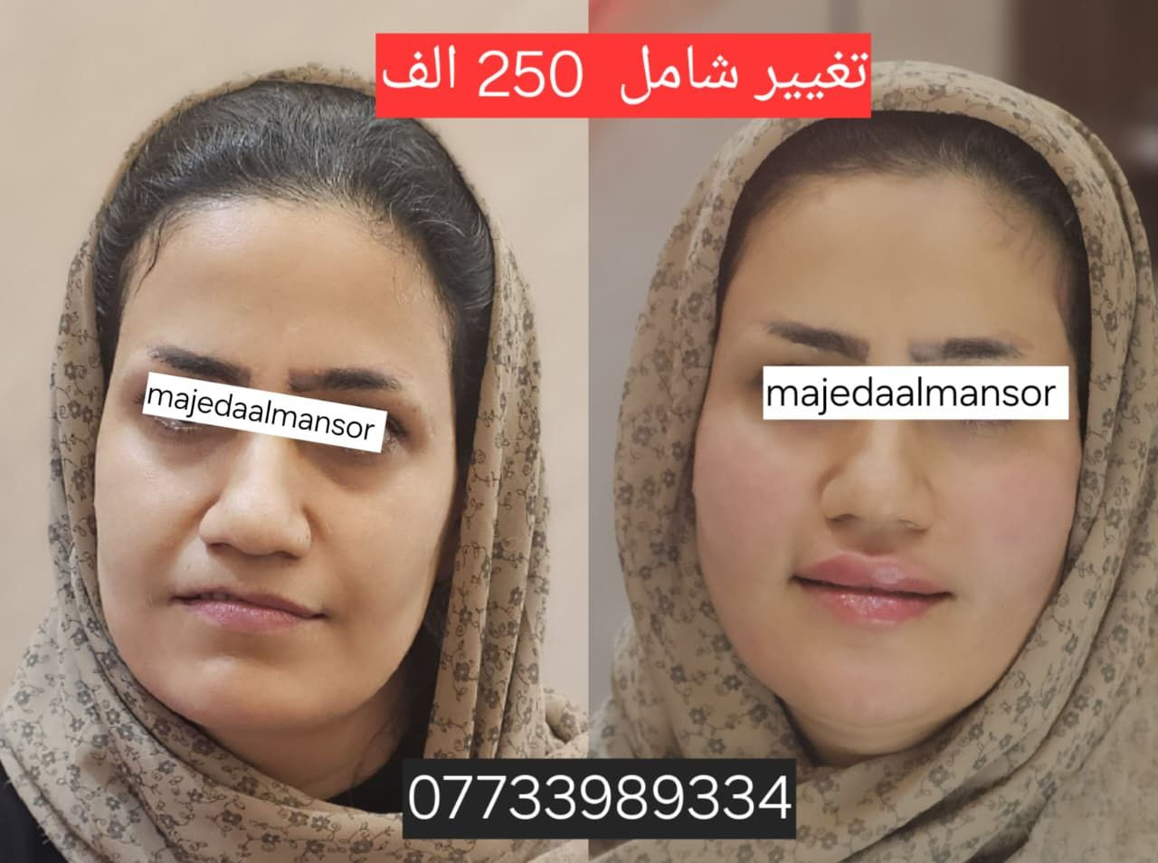 التغيير الشامل يمنه وبس  👄💅

هدية ابرة كريستال مع كل تغيير شامل 
عروض  الدكتورة ماجدة المنصور Jojo Alnabeel 
العنوان بغداد الحسينية مقابل السوق الكبير مجاور مرطبات العذراء
مجمع سما الحسينيه للطابق الثاني قسم التجميل والصالون ***********
