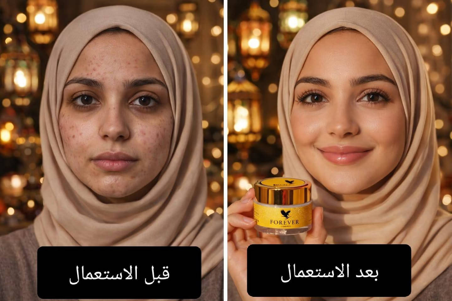 بنات هاي الخلطةدمار تخلي وجهج كزازة يوج وج شاهد الله عليه وبيه ضمان فلوسج ترجعلج بس  والقران تصفي وجهج وتبيضه مابيه خسارة تعاني من كلف عنيد وما لقيتِ حل؟
خلطة فوريفر للوجه تساعد على:
✔ تفتيح التصبغات
✔ توحيد لون البشرة
✔ ترطيب وتغذية عميقة
✔ إشراقة طبيعية بدون إرهاق البشرة

منتجات طبيعية…
نتائج تُلاحظ مع الصبر والاستمرار ✨

الخلطله الملكيه💫


**إذا كنت صاحب هذا الإعلان وتريد حذفه لأي سبب، رجاءا أرسل رسالة إلى الدعم الفني**