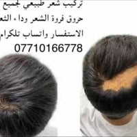 تركيب شعر • فراغات • ثعلبة