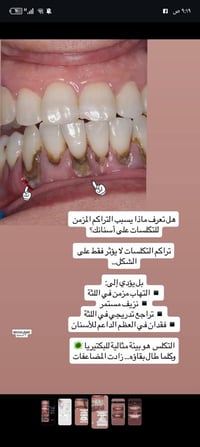 الضياء سمايل • تجميل أسنان • السماوه حي المعلمين