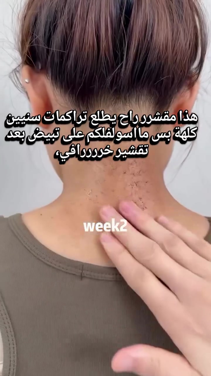 #اكسبلور #سكنكير✨💆🏻‍♀️ #عناية_بالبشرة #العراق_السعودية_قطر_الامارات_الكويت_البحرين_اليمن_الخليج_سوريا_مصر_لبنان_الجزائر_تونس_المغرب_قطر_دبي #beautyofjoseon


**إذا كنت صاحب هذا الإعلان وتريد حذفه لأي سبب، رجاءا أرسل رسالة إلى الدعم الفني**