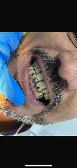 الى الاهالي الكرام ♥️

نود اعلامكم عن افتتاح عيادة طب وجراحة الاسنان
داخل مجمع الزيتون الطبي 

الدكتورة/سميرة مهدي جاسم 
-تنظيف وتبييض الاسنان 
-قلع الاسنان
-حشوات عادية وتجميلية وجذور 
-جسور المتحركة والدائمية 
-علاج اسنان الاطفال 

حسب الاوقات التالية :من الساعة الرابعه عصراً وحتى الثامنة مساءاً (٤-٨)
موقع العيادة:مجمع الزيتون الطبي /هور رجب مقابل افران الزيتون 
للاستفسار الاتصال على الهاتف ***********

(ابتسامتك هي سر جمالك) 

تنورونا ♥️
