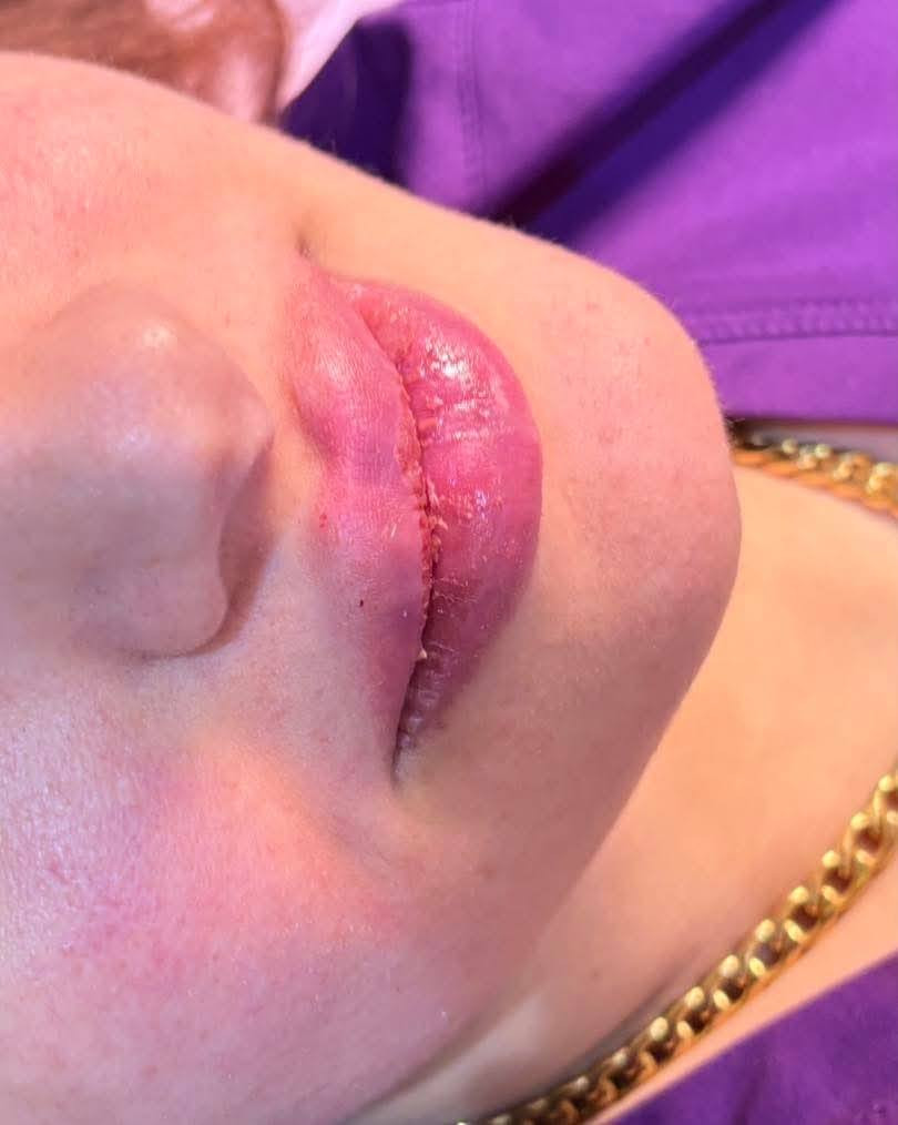 ✨ رحلة الابتسامة تبدأ بخطوة ✨
عياده روح لطب وتجميل الاسنان 
د.زهراء صادق 
انصح الكـل تجرب شغلهم 
تشتغل بنضام الأقساط
دخلو ع الصفحه وشوفو باقـي شغلهـم

نتيجة من نتائج تقويم الأسنان في عيادة روح 🦷💙

مو بس ترتيب الأسنان، وإنما تحسين الإطباق، راحة أكبر أثناء المضغ، وابتسامة أكثر ثقة وجمالاً.

روح هوه خياركم الاول لضمان سلامتكم
العنوان : المحموديه _ سوق المحموديه-شارع الاطباء -

للاستفسار:
***********
***********
