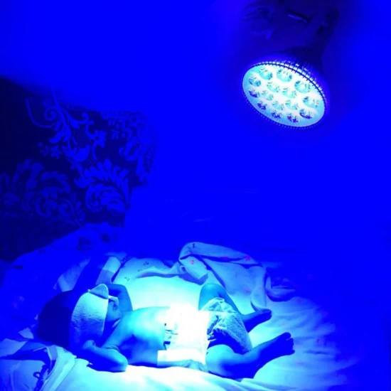 جهاز علاج ابو صفار للأطفال حديثي الولادة
واتساب ***********
