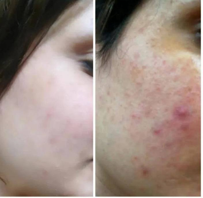 مع منتجات لدورا الأيرانيه لا تحتار
توصيل لجميع المحافظات العراق 🇮🇶
*********** واتساب 
نتائج عمل منتجات شركه لدوره 💪🔥
