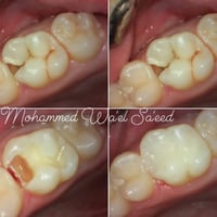 قرب جامع التوحيد • طابق أرضي • قبل وبعد
