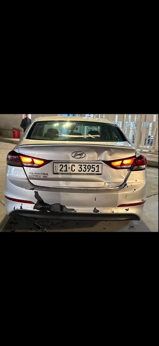 سلام عليكم
النترا 2018 محرك 2000 دوش مبدل جديد لا تنقيص ولا بتخير السيارة بيها 4 قطع جامرلغين وبنيد بدوووون دواخل شرط وحدة منها كلير و والضربة بالجنطة موضحة بالصوة مكاني مدينة الصدر السعر 120بيها مجال كلش بسيط الخاص مغلق اتصل ***********
