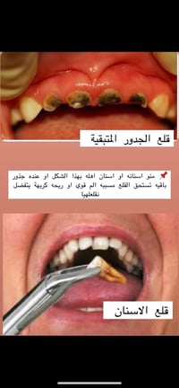 الي محتاج هيج علاج حسب الحالات الي بالصور يتواصل واتساب /07754255335