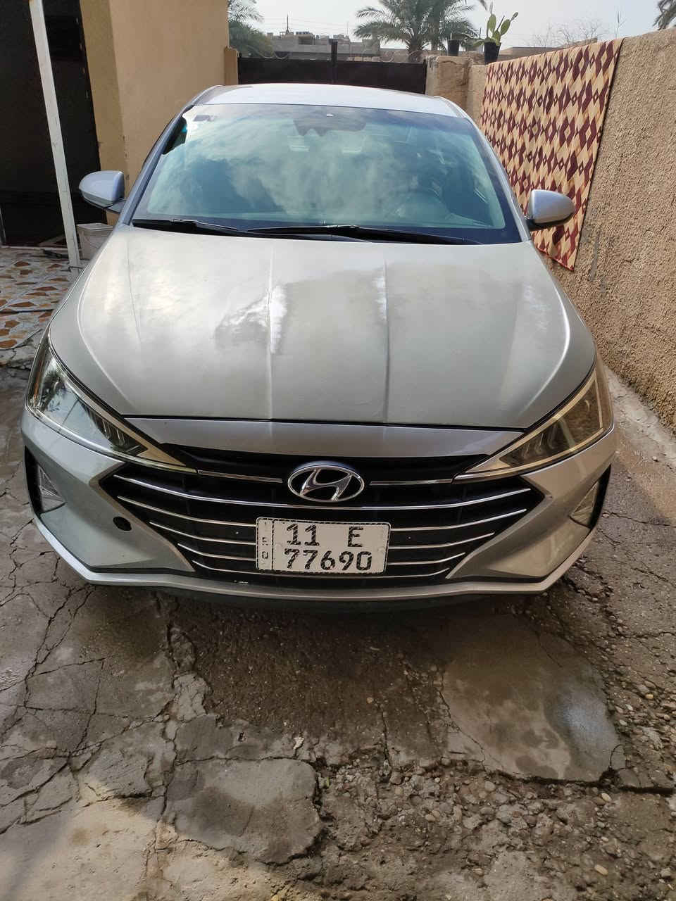 السلام عليكم
سيارة النترا موديل 2020 السيارة كفاله عامة من تبديل السيارة ليبل واحد وحادثه بنيد نفسه مرجع وصورهه بل منشور بدون ايرباكات 
السيارة بيع او مراوس بي واي دي دست رويل 
السعر 128 
للتواصل والاستفسار 
***********
بي واتساب
