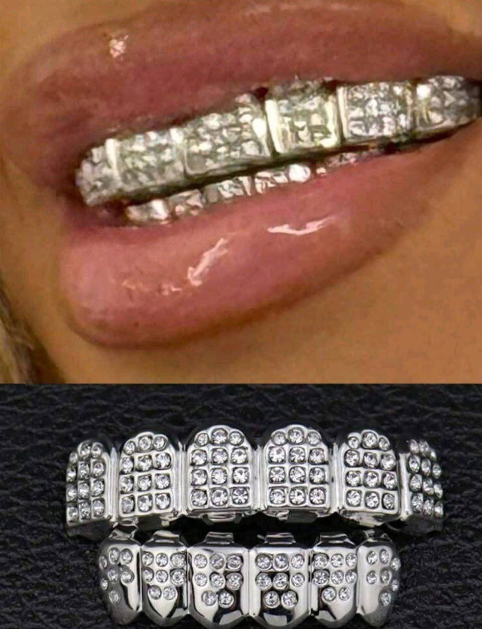 اسنان فضية بهل شكل اليفيدة ينطينا بي سعر وياخده


**إذا كنت صاحب هذا الإعلان وتريد حذفه لأي سبب، رجاءا أرسل رسالة إلى الدعم الفني**