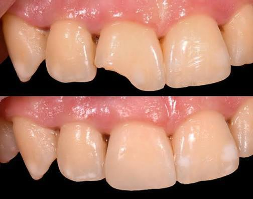 مجانا.
قلع الاسنان التالفه والجذور المتبقيه
حشوات ضوئيه تجميليه 
تنضيف الاسنان 
طقم اسنان متحرك جزئي
علما ان العلاج مجاني 
للتواصل الاتصال على الرقم التالي او التواصل على الواتساب ***********
انستا @_2__ii
كربلاء
خلف مول الحارث
