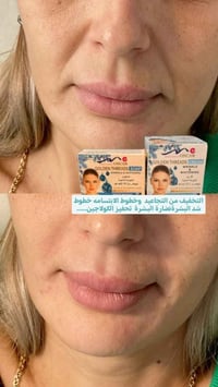 خيوط ذهبية • كولاجين • كريم وصابونة