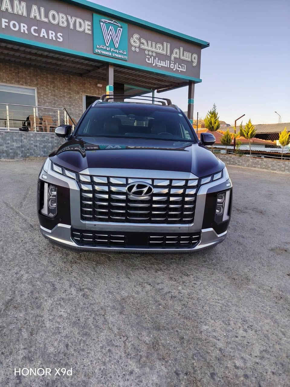 نـــوع الســـيارة /  HYUNDAI PALISADE CALLIGRAPHY

مــوديل الســـيارة / 2024  
           
  * اخي العزيز اضغط متابعة يوصلك كل ماهو جديد *

🎈 السيــارة تدخل عـلى اعــفاء كتــاب الشهـداء 🎈 

حجم المحرك 3.8  
عداد المـسافة / 59 الف mi
مواصفات السيارة :  فول مواصفات (CALLIGRAPHY) اعلى صنف موجود 

 عنوان المعرض ⬅️ في الاردن 📍المنطقة الحرة الزرقاء شـــــارع 18 شـــــمـــال                      

ضرر السيارة واضح في الصور 

الاستفسار او الاتصال واتساب 📞  ***********
