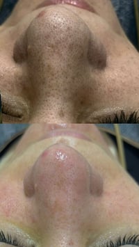 صالون ليدي • تنظيف بشرة عميق • سامراء حي المثنى