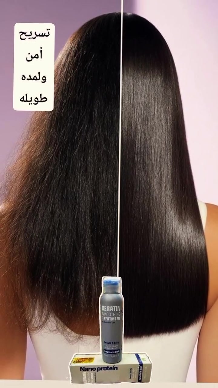 اكيد انتي تعبانه من السشوار والكاويه يوميه قبل ما تروحين للدوام او الطلعات السريعه والمفاجئه.. ف اني وفرتلج مسرح تستخدمي مره وحده وراح يسرحلج شعرج مده 6 اشهر وتخلصين من هاي الدوخه
#مسرح_ومعالج_نانو_بروتين
هم مسرح وهم معالج يعني 2 في 1
تضمنين تسريح ++عدم تلف للشعر
#شعر #تساقط #شعر_صحي
اكيد انتي تعبانه من السشوار والكاويه يوميه قبل ما تروحين للدوام او الطلعات السريعه والمفاجئه.. ف اني وفرتلج مسرح تستخدمي مره وحده وراح يسرحلج شعرج مده 6 اشهر وتخلصين من هاي الدوخه


**إذا كنت صاحب هذا الإعلان وتريد حذفه لأي سبب، رجاءا أرسل رسالة إلى الدعم الفني**