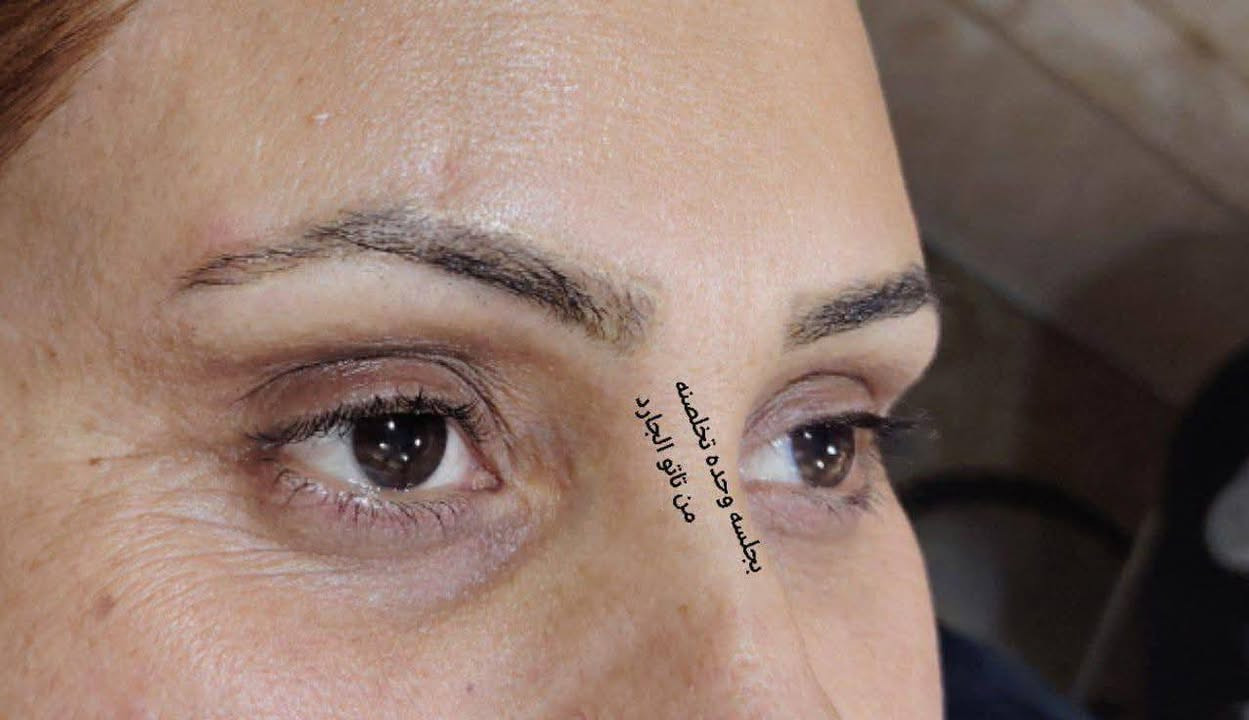 ازلاله مسح بماده حبريه امريكيه اجنن من اول جلسه بدون اي تأثير عل الجلداوحروق يرجع حاجبج طبيعي بشرط 👍
المدربة الكوافيره ام محمد 🧿🧿
صالون ورده بغداد 🌺🌺
والاستفسار على الواتساب 👈 ***********☎️🧿

السماوه حي الحسين 🙏🧿
خلف مطعم بولفارد
على الحجز قبل بيوم👉👉👉📞
ازلاله مسح بماده حبريه امريكيه اجنن من اول جلسه بدون اي تأثير عل الجلداوحروق يرجع حاجبج طبيعي بشرط 👍
ازلاله مسح بماده حبريه امريكيه اجنن من اول جلسه بدون اي تأثير عل الجلداوحروق يرجع حاجبج طبيعي بشرط 👍
