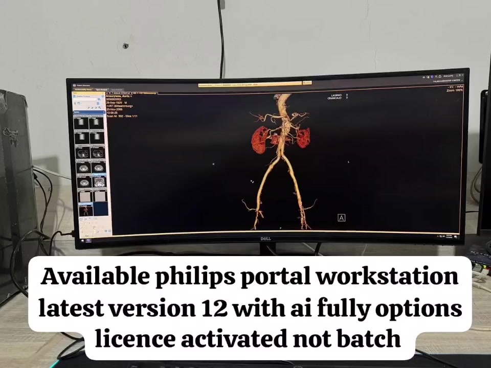 هل تبحث عن أقوى برنامج لتحليل صور الأشعة الطبية؟
نقدم لكم Philips IntelliSpace Portal 12 بأحدث إصدار مع تفعيل لايسنس أصلي وإمكانية التقسيط.

💎 المميزات:

✅ عرض وتحليل صور CT – MRI – PET – NM – Ultrasound
✅ إنشاء صور ثلاثية ورباعية الأبعاد 3D / 4D
✅ تحليل متقدم للأوعية الدموية والقلب
✅ تحليل الأورام والدماغ والرئة والكبد والعظام
✅ سرعة عالية جداً في المعالجة
✅ إمكانية التنصيب على:

💻 لابتوب
🖥️ حاسوب مكتبي
🖥️ Workstation احترافي
🖥️ Server + Client

🔐 الخدمات المتوفرة:

✔️ تفعيل لايسنس أصلي
✔️ تنصيب كامل وضبط الإعدادات
✔️ تشغيل جميع التطبيقات
✔️ دعم فني كامل

💳 إمكانية التقسيط متوفرة

📍 مناسب للمستشفيات ومراكز الأشعة

📞 ***********
📍 بغداد – خدمة جميع المحافظات

---

Looking for the most powerful medical imaging analysis software?
We provide Philips IntelliSpace Portal 12 with Original License Activation and Installment Plans Available.

💎 Features:

✅ Advanced DICOM Viewer for CT, MRI, PET, NM, and Ultrasound
✅ High-performance 3D / 4D visualization
✅ Advanced Vessel and Cardiac Analysis
✅ Oncology, Brain, Lung, Liver, and Bone Applications
✅ Ultra-fast image processing
✅ Can be installed on:

💻 Laptop
🖥️ Desktop Computer
🖥️ Professional Workstation
🖥️ Server + Client

🔐 Services Included:

✔️ Original License Activation
✔️ Full Installation and Configuration
✔️ All Clinical Applications Enabled
✔️ Full Technical Support

💳 Installment Available this method only in iraq

📞 +964 750 254 2418
📍 Baghdad – Service Available Across Iraq

---

#Philips
#IntelliSpacePortal
#Portal12
#Radiology
#MedicalImaging
#PACS
#DICOM
#Paxi_iq
#Baghdad
