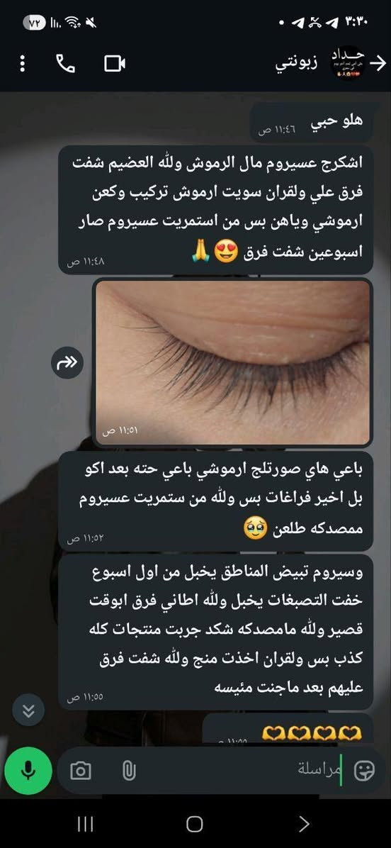 رموشج خفيفة وتوكع؟ لا تخافين، مافالا السويسري يعالج الضعف ويخلي الشعراية سميكة وقوية. وداعاً للفراغات وأهلاً بالإطلالة الجذابة 
سر جمال العيون برموشها. دللي عيونج بأفضل سيروم بالعالم، مافالا دبل لاش تطويل آمن وطبيعي وبدون أي آثار جانبية

للاستفسار خاص بغداد, العراق


**إذا كنت صاحب هذا الإعلان وتريد حذفه لأي سبب، رجاءا أرسل رسالة إلى الدعم الفني**