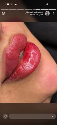 حي الجهاد سنتر • ايڤا • ايراني