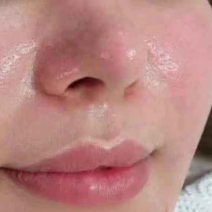 فوائد الخلطه
تفتيح لون البشرة وتوحيدها، مكافحة البقع الداكنة وعلامات الشيخوخة المبكرة، وتقشير البشرة بلطف وإزالة خلايا الجلد الميتة. كما يعمل على تهدئة البشرة وتوفيرها بالفيتامينات اللازمة للحفاظ على صحتها ونضارتها، وله خصائص تمنع ظهور حب الشباب. حلة, بابل


**إذا كنت صاحب هذا الإعلان وتريد حذفه لأي سبب، رجاءا أرسل رسالة إلى الدعم الفني**