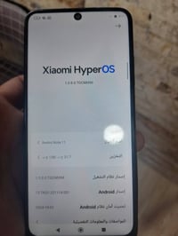 ريدمي ١١ • ١٢٨ • شاصي تعبان