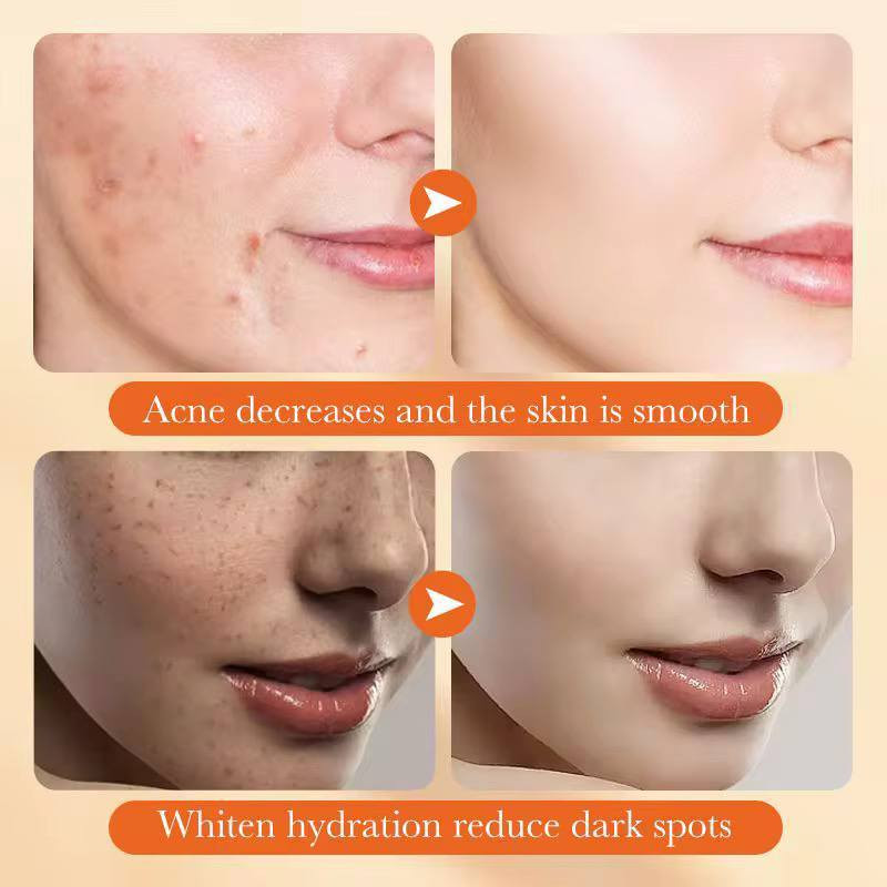 لوشن Sadoer Oats Amino Acid Soothing Lotion (لوشن سادور المهدئ بالأحماض الأمينية والشوفان). 

✅يحتوي على 98% من الأحماض الأمينية المشتقة من الشوفان. 

✅مصمم للترطيب اللطيف وتنعيم البشرة وشدها. 

✅آمن للاستخدام أثناء الحمل للمساعدة في تقليل ظهور علامات التمدد. 

✅يساعد على تبييض البشرة وترطيبها وتغذيتها.

الحجم 100ml
مع توصيل 20الف 
يوجد توصيل جميع المحافظات العراق


**إذا كنت صاحب هذا الإعلان وتريد حذفه لأي سبب، رجاءا أرسل رسالة إلى الدعم الفني**