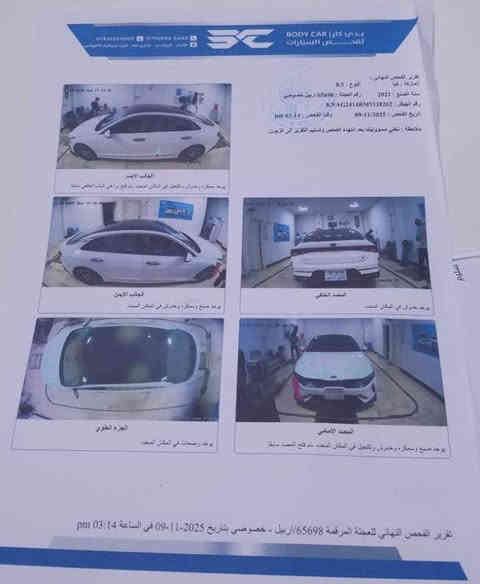 كي فايف K5

‎خليجي موديل 2021 رقم اربيل بيها بارد  بالهلال  الامامي معدل على البارد وشوي من البنيد وصبغ شوي من دعامية كما موضح بالسونار لباقي مكفول كفالة عامة من ظربة والصبغ محرك 2000

مواصفات 

بنراما 

بصمة تشغيل عن بعد 

كامرات 

رادرات

3 انظمة قيادة 

وغيرها من المواصفات المعروفة بالk5

  

سيارة بيها وكالة عامة يعني تتحول بنفس اليوم ماشية113 الف كيلو السعر 195 ورقة رقم صاحبها ***********‏ الرمادي
