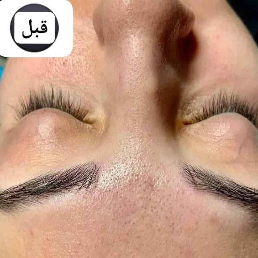 عرض الاخوات والصديقات 👩‍❤️‍👩
      تنظيف البشره الملكي انت واختج 
ب٢٥
رموش كامله انتي واختج ب٢٥
حجز مسبق.


**إذا كنت صاحب هذا الإعلان وتريد حذفه لأي سبب، رجاءا أرسل رسالة إلى الدعم الفني**