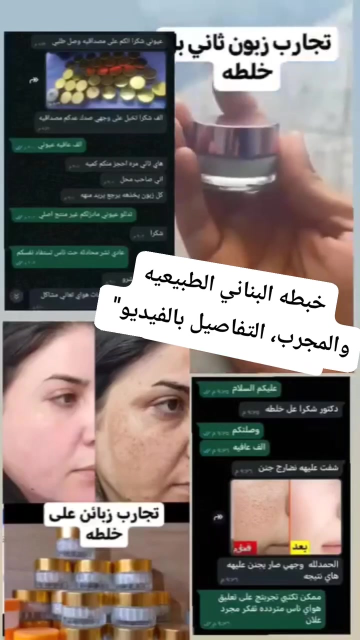 الكريم اللبناني مبيض للوجه

شد البشرة
تفتيح البشرة 

ازالة الكلف واثار حب الشباب 

ازالة الهالات السوداء تحت العين. 

يعطي نضارة دائمه #الجميع @إشارة


**إذا كنت صاحب هذا الإعلان وتريد حذفه لأي سبب، رجاءا أرسل رسالة إلى الدعم الفني**