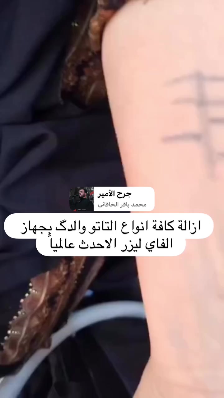 عيادة فور يو لليزر
ازالة كافة انواع التاتو ( تاتو الجسم، تاتو الحواجب ، الدگ) بجهاز الفاي ليزر الاحدث عالمياً في هذا المجال للنساء والرجال. 
للحجز والاستفسار ***********
الانستغرام foryoybeauty2026
