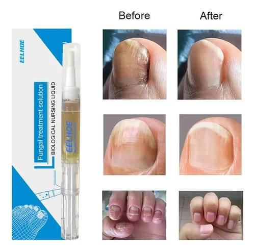 اي قطع 5 الف


**إذا كنت صاحب هذا الإعلان وتريد حذفه لأي سبب، رجاءا أرسل رسالة إلى الدعم الفني**