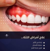 حشوات جذور • تركيبات زاركون • خصم ٤٠٪