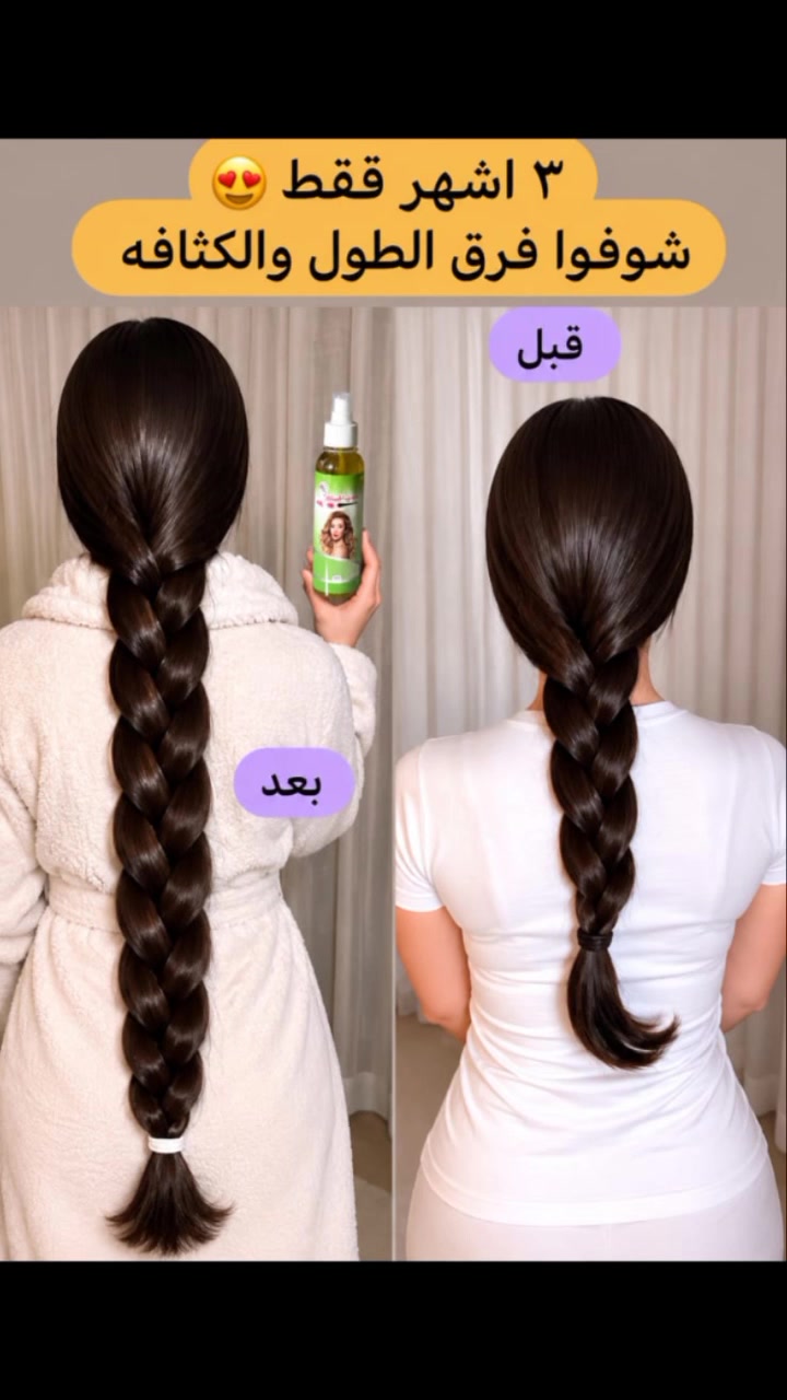 منتج الشعر ينطي كثافه ونعومه وتطويل لشعر بسعر مناسب ومجرب متوفر عنده شركه سيدتي الجميلة فقط.


**إذا كنت صاحب هذا الإعلان وتريد حذفه لأي سبب، رجاءا أرسل رسالة إلى الدعم الفني**