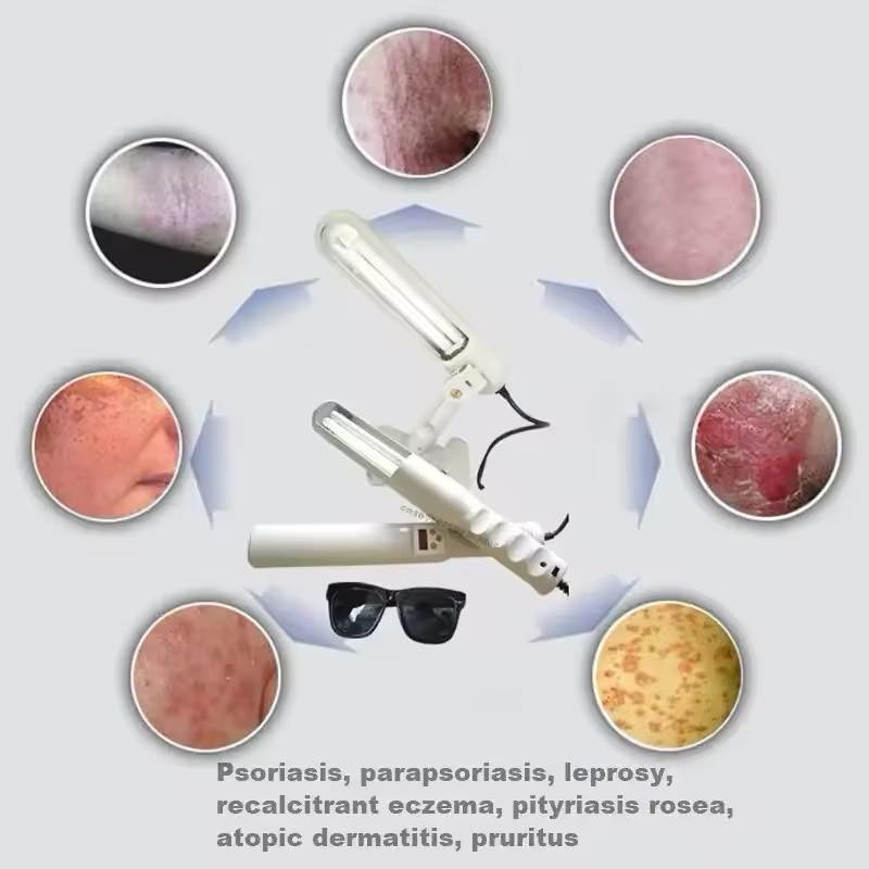 جهاز العلاج بالضوء بالأشعة فوق البنفسجية 311 نانومتر يستخدم مصباح فيليبس UVB لعلاج البهاق والصدفية والبقع البيضاء وأمراض البشرة


**إذا كنت صاحب هذا الإعلان وتريد حذفه لأي سبب، رجاءا أرسل رسالة إلى الدعم الفني**