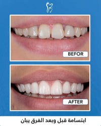 "🦷 أسنان صحية وابتسامة مشرقة...  في مراكز الشركة الطبية العالمية ، نوف...