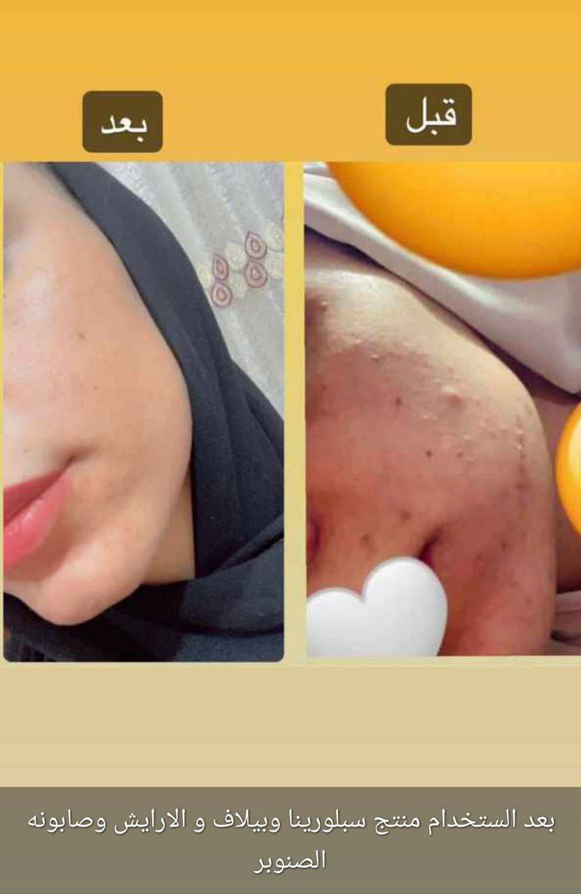 مع منتجات لدورا الأيرانيه لا تحتار
توصيل لجميع المحافظات العراق 🇮🇶
*********** واتساب 
نتائج عمل منتجات شركه لدوره 💪🔥
