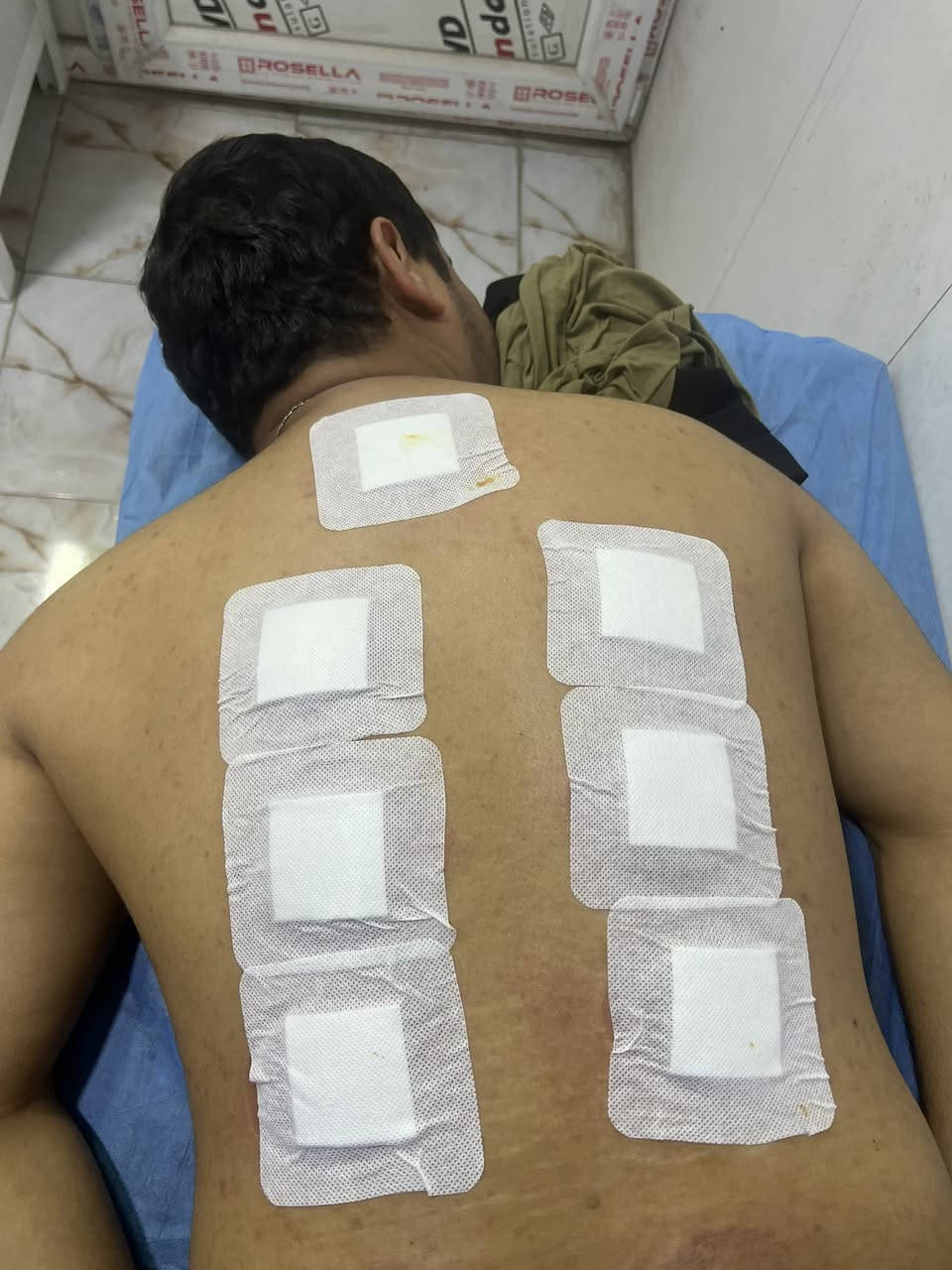 الحجامه النبويه والعلاجيه
. قال رسول الله ﷺ:

«إِنَّ أَمْثَلَ مَا تَدَاوَيْتُمْ بِهِ الحِجَامَةُ»

👉 المعنى: من أفضل وسائل العلاج الحجام

 ✨ الحجامة النبوية – طريقك للصحة والعافية ✨

هل تعاني من:

✔️ صداع مزمن  

✔️ آلام الظهر والرقبة  

✔️ إرهاق وتعب مستمر  

✔️ توتر وقلة نوم  

🔸 الحجامة تساعد على:

✔️ تنشيط الدورة الدموية  

✔️ تخفيف الألم والالتهابات  

✔️ تحسين النشاط والطاقة  

✔️ الاسترخاء وتقليل التوتر  

📌 بإشراف مختصين وبأدوات معقمة 100%  

📌 خدمة آمنة وفق الشروط الطبية  

📍 الموقع: الكرغوليه سايد الواحد مقابيل مول الامراء  

📞 اتصال: ***********  

📲 واتساب: ***********  

زورو الصفحه وتابعو المنشورات والعمل
