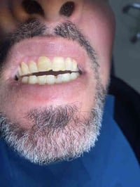 حشوات ضوئية في جامعة كلكامش مجاناً للاستفسار الاتصال او مراسلتنا على ا...