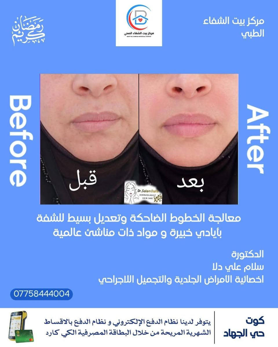 أهلاً وسهلاً بكم في مركزنا 💯مركز بيت الشفاء الطبي 💯
 في عيادة الدكتورة سلام علي دلا 🧑‍⚕️  المختصة في الأمراض الجلدية والتجميل والليزر 💯💯

. مختصة في الأمراض الجلدية والتجميل والليزر 
.طبيبة جلدية وتجميل داخل مركز بيت الشفاء الطبي 
.متحصلة على شهادة  معتمدة من نقابة الأطباء في الطب التجميلي الأساسي 
.متحصلة على شهادة معتمدة من وزارة العمل في التجميل الطبي 

📍موقع المركز:
الكوت /حي الجهاد/نهاية شارع الگراج/قرب محلات أبو سعدون 

للحجز والاستفسار:
مراسلة حساب المركز (مركز بيت الشفاء الطبي)💯
او الاتصال على الرقم الآتي :***********
