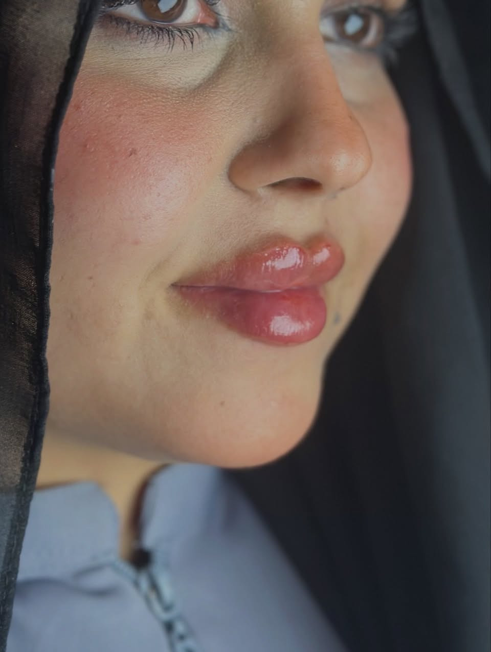 اكو احلى من هيج جمال بالحقن🙂‍↔️🔥🔥
الدكتورة ساره عدنان 💉
للحجز والاستفسار الاتصال المباشر للرقم :***********
