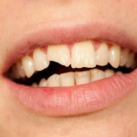 خدمات اسنان • علاج مجاني رمضان • كربلاء السعدية