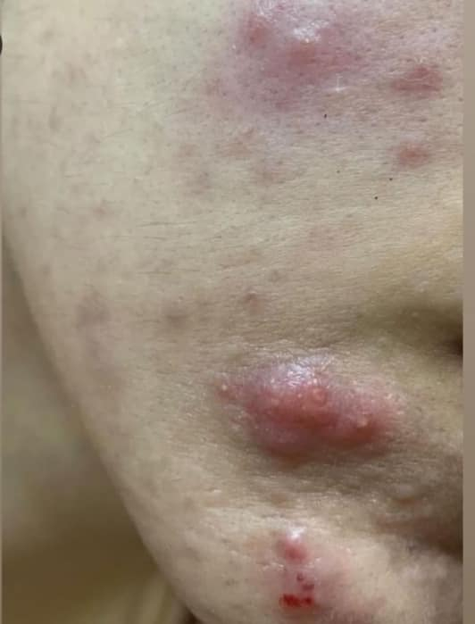 ‎خلطة رجالية /نسائيه

‎لتبيض الوجه 🔴علاج الكلف بالوجه حب الشباب واثاره 🔴التصبغات 
‎و عدم صفاء ونقاوة البشره 
‎الهالات السوداء

‎ خلطه تبيض الوجه وازالة الكلف والنمش المنتج
‎🌹خلطة  السحريه لتبيض الوجه  وبمفعول دائمي 😍
‎كل هذا بسر نجاح خلال اسبوع فقط لاغير لان سر جمالك هو اختصاصنا😍
‎المنتج مضمون ١٠٠٪


**إذا كنت صاحب هذا الإعلان وتريد حذفه لأي سبب، رجاءا أرسل رسالة إلى الدعم الفني**