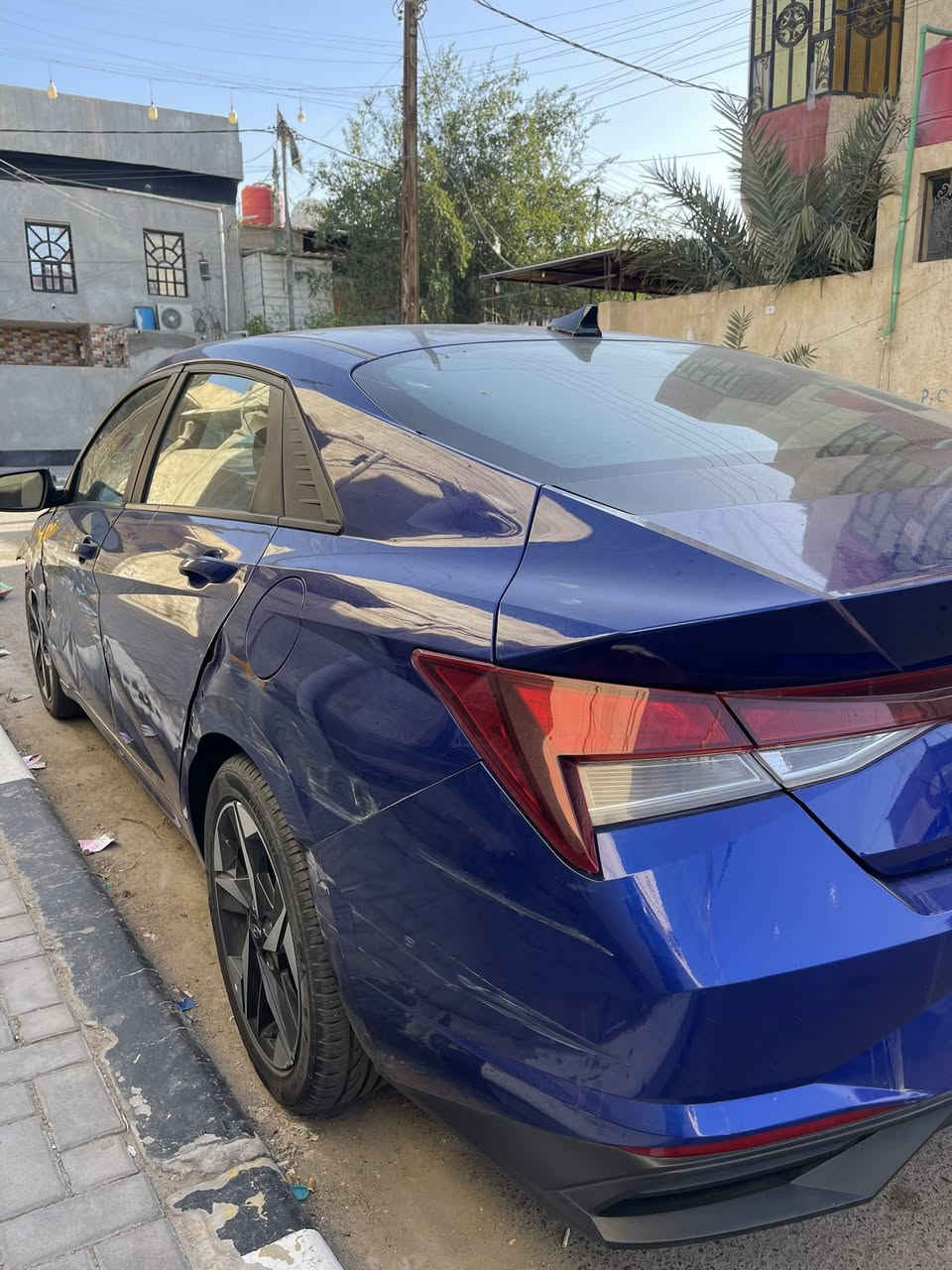 النترا 2023 رقم معوقين بصرة حادث امريكا فقط بنيد و بالعراق صار بيها هذا الحادث ابيع على وضعها 
115 و بيها مجال 
***********
