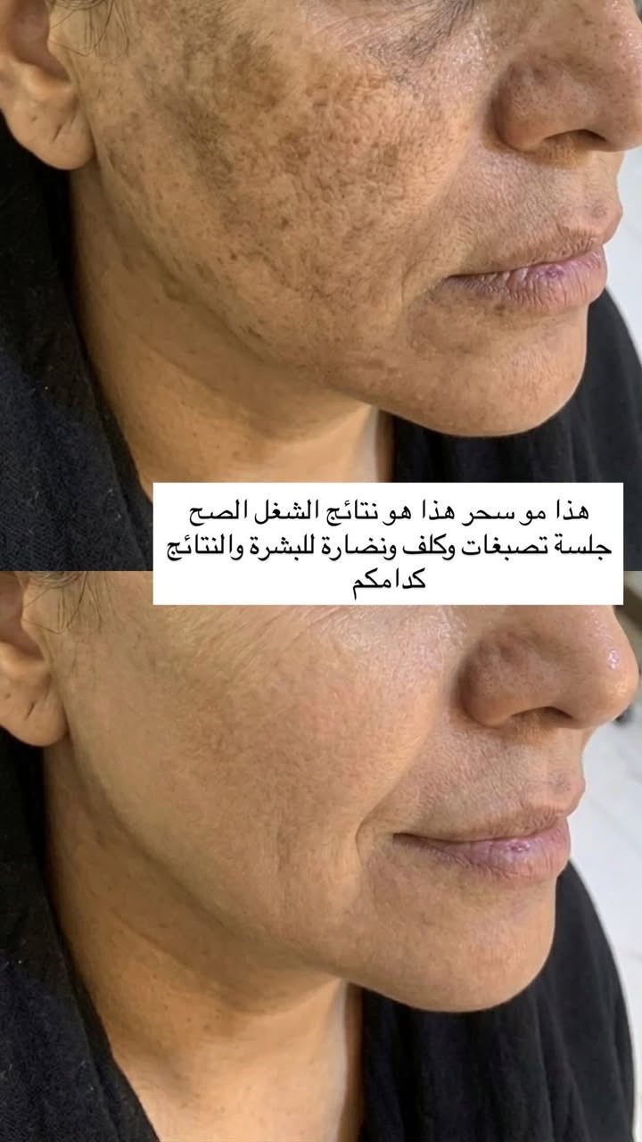 استغلوا العروض 
الموقع/ زيونة 710 خدمي دريم ستي 
للاستفسار/ ***********
