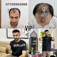 المبدأ واحد… لكن الفارق يظهر في الخبرة، الدقة، والتفاصيل.  في زراعة ال...