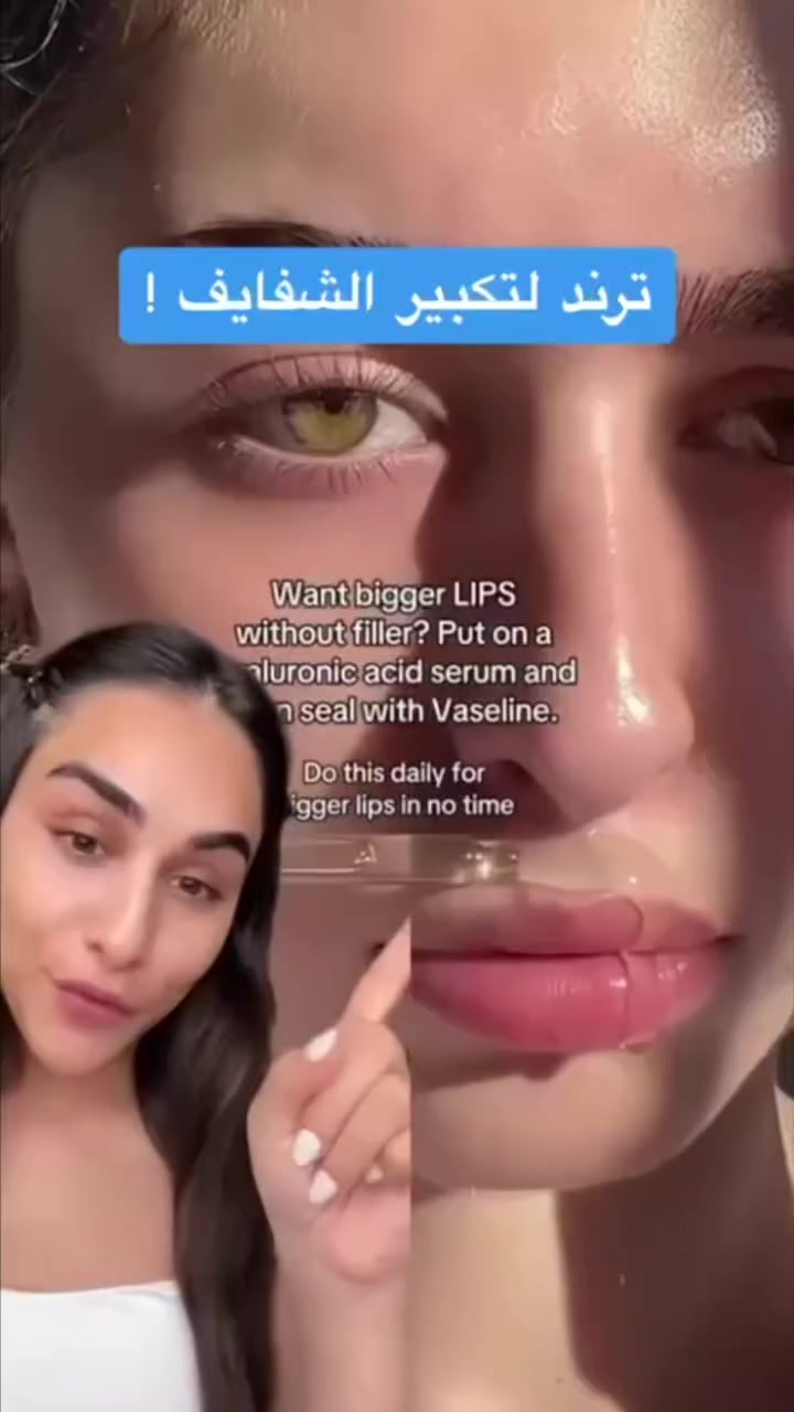 🤛عرض خاص💋 
 #ترند طبيعي ومفيد جداا 🥰مكس تفتيح وترطيب وامتلاء ومعالجة الشفه💋
بعيدا عن الفلر والترسبات الخطرة المتبقية له ع مدار السنين وفرنا لكم عرض طبيعي اصلي يتكون من ؛ سيروم هايلورونيك اسيد من اوردنري +فازلين طبي اصلي 💯
1️⃣سيروم هايلورونيك اسيد اوردنري 
⭐ تحفيز إنتاج الهايلورونيك اسد في البشرة,وبالتالي يقوم بملىء بشره الوجه.
⭐العمل على نفخ الشفاه ،ويعتبر بديلاً لفلر شفه. 
⭐معالجة الجفاف في الشفه .
⭐يعالج ظهور التجاعيد مبكراً 
⭐يعزز من مرونة الجلد . 
⭐الوقاية من الأشعة فوق البنفسجية من الشمس والتي تسبب تلف الجلد ، وجفاف البشرة .
اوردنري الامريكي 💯🇺🇸

2️⃣مرطب فازلين نقي بدون عطر 
✨ مرطب شفاه من فازلين لترطيب قوي وفعال
✨ الحل الأمثل لجفاف الشفاه في الشتاء 
✨ يكسب الشفاه لون وردي رائع  
✨ يعالج الجفاف والتشققات ويغذي الشفاه جيدا
✨ غني بالفيتامينات وزبدة الشيا 
✨ يعطي الشفاه ملمس ناعم وحيوي
طريقة الاستخدام:
يوضع سيروم هايلورونيك وننتظر إلى أن تمتصه الشفه ونضع الفازلين استمري وراح تتفاجئين بالنتيجة💋

#سعر العرض 13الف

متوفر خدمه #توصيل كافة محافظات العراق 🚕 @


**إذا كنت صاحب هذا الإعلان وتريد حذفه لأي سبب، رجاءا أرسل رسالة إلى الدعم الفني**