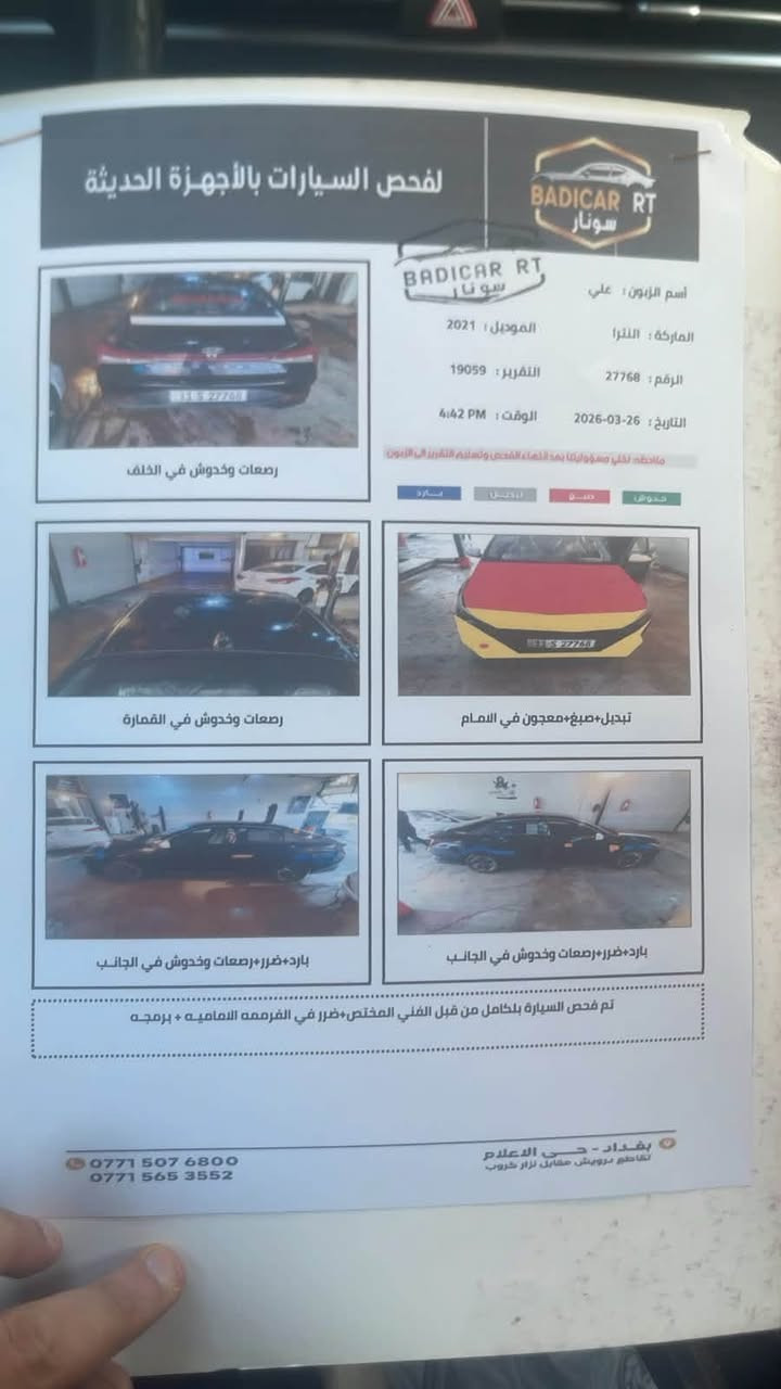 السلام عليكم النترا 21لون اسود هايبرد . السيارة حادثها دعاميه اماميه فقط بدون دواخل بدون ايربك و هنا خشم البنيد 
تبريد راديترات شركة

المواصفات

 بصمة 
لايتات زنون 3 عدسات
سستم صوت 
فول بصمات
شاشة كبيرة 
محرك 2000 دوش 🚀
كامرة دوارة
بصمة صندوك
ترحيب عند الاقتراب
صندوق ذكي
دخول ذكي 
بصمة ابواب
تشغيل عن بعد
رادار امامي
رادار خلفي
رادار جانبي
تدفئة كشنات
تدفئة ستيرن
تحديد مسار
قيادة ذاتية
توقف ذاتي 
تنبيه عند مغادرة المسار
وضعيات قيادة
صندوق ذكي
وبعد هواي مواصفات بيها

سيارة جاهزة وكاملة بدون نقص

السعر١٢٥ وبيها مجال 

بغداد ***********

