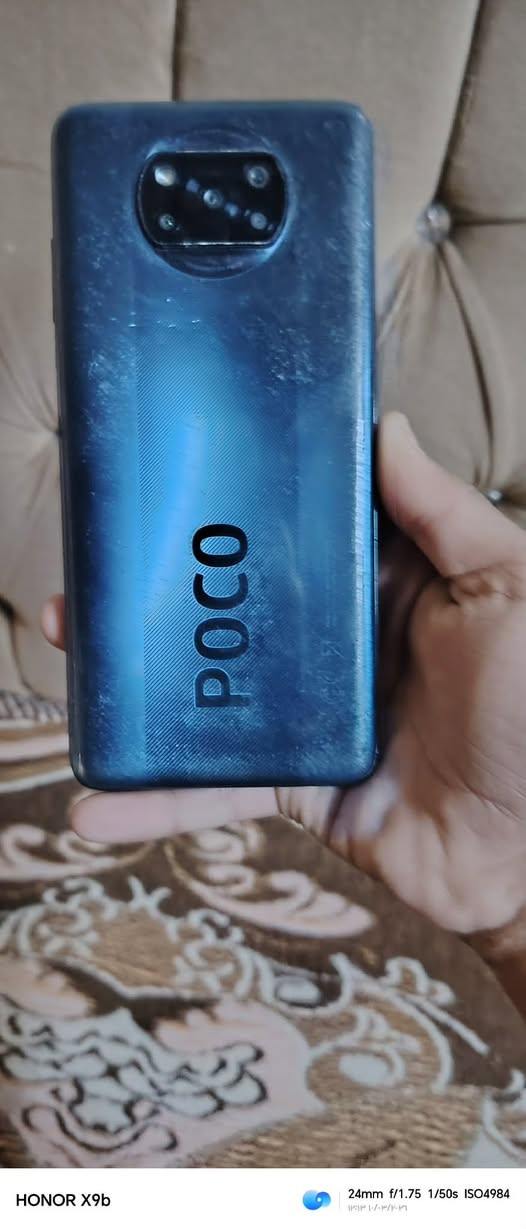 السلام عليكم بوكو ذاكره 256 الرام 8  ما مفتوح 
يطفى ويعلق موصل حي القاهره السعر 75 بمجال 
الخاص وراسلني ***********
